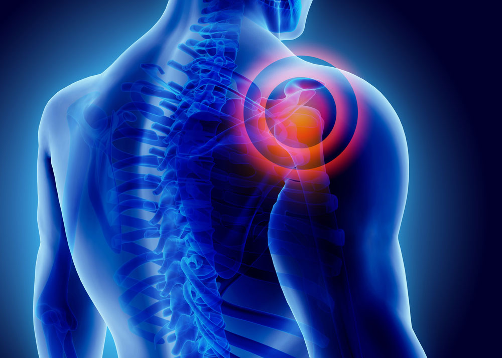 Shoulder Pain in man