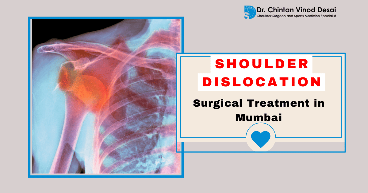 Surgical Treatment for Shoulder Dislocation in Mumbai Guide
