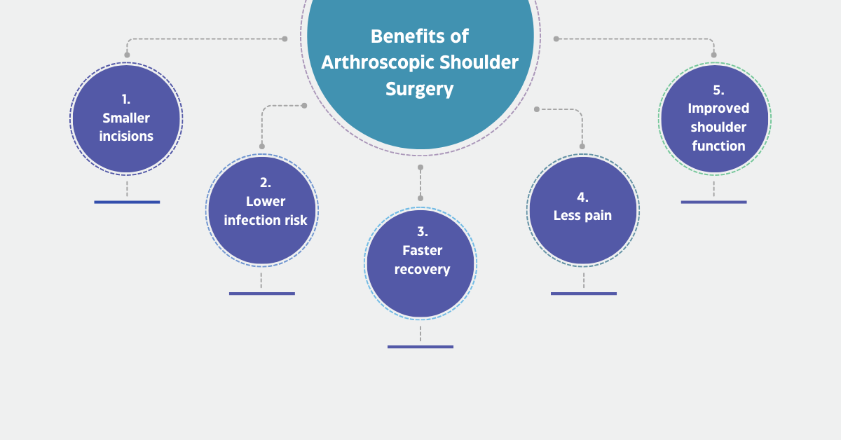 Benefits of Arthroscopic Shoulder Surgery