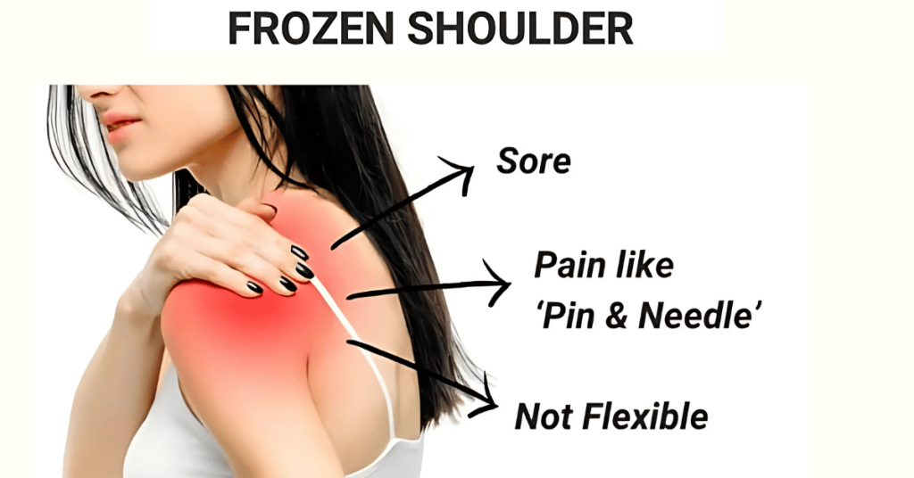 Symptoms of Frozen Shoulder