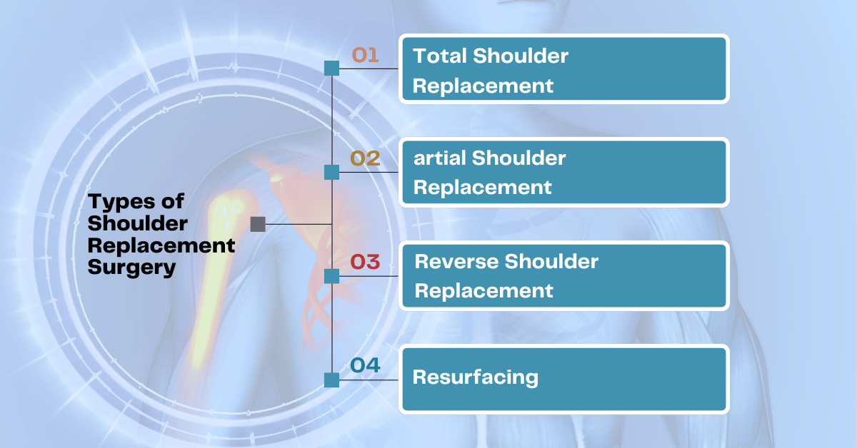 Types of Shoulder Replacement Surgery
