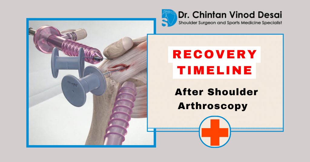 How Long Does It Take to Recover After Shoulder Arthroscopy?