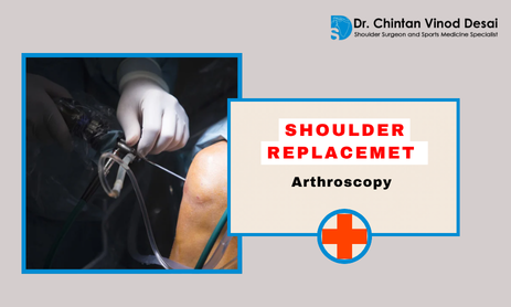 Shoulder Replacement vs Arthroscopy: Which Is Right for You?