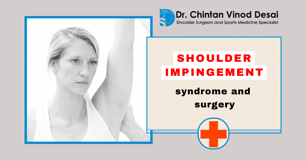 Understanding Shoulder Impingement Syndrome and When Surgery is Necessary