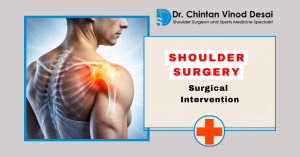 Read more about the article Is Shoulder Surgery Right for You? Key Signs You Need Surgical Intervention