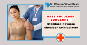 Read more about the article Best Shoulder Surgeons in Mumbai for Stemless Reverse Shoulder Arthroplasty: What You Should Know