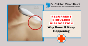 Read more about the article Recurrent Shoulder Dislocation: Why Does It Keep Happening?