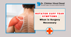 Read more about the article Rotator Cuff Tear Symptoms: When Is Surgery Necessary?