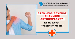 Read more about the article Stemless Reverse Shoulder Arthroplasty in Mumbai: What You Should Know About Treatment Costs