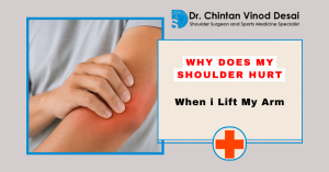 Read more about the article Why Does My Shoulder Hurt When I Lift My Arm? Causes, Symptoms & Treatment Explained