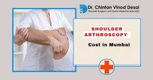 Read more about the article Shoulder Arthroscopy Cost in Mumbai: Complete Guide to Treatment Expenses