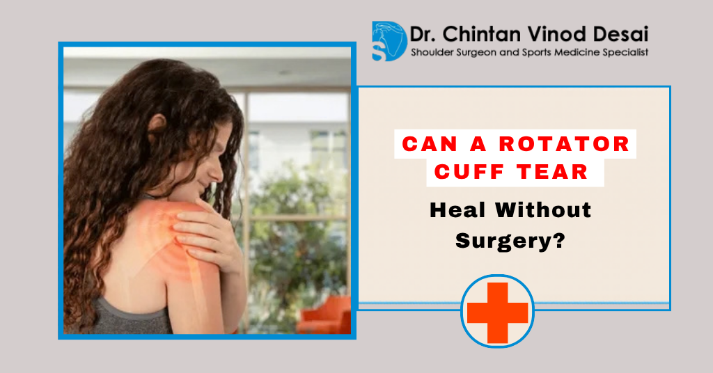 You are currently viewing Can a Rotator Cuff Tear Heal Without Surgery?