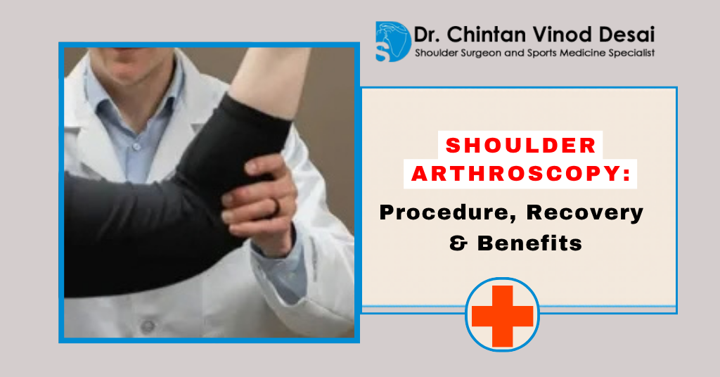 Read more about the article Shoulder Arthroscopy: What Is It and When Is It Recommended?