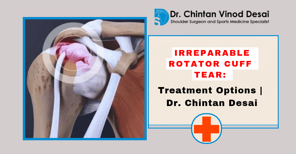 Read more about the article Irreparable Rotator Cuff Tear: Treatment Options Beyond Traditional Surgery