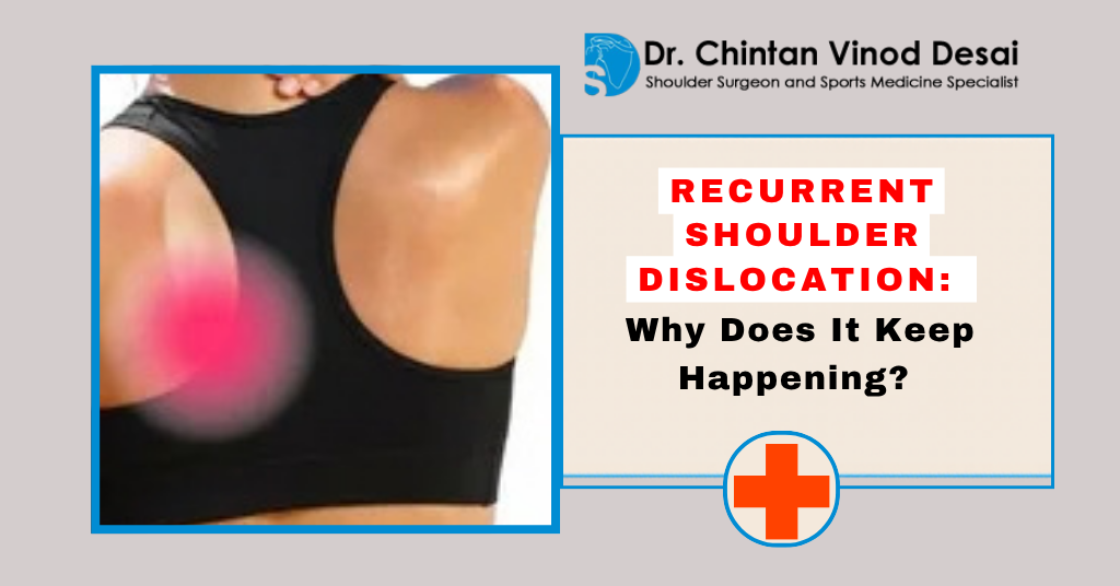 You are currently viewing Recurrent Shoulder Dislocation: Why Does It Keep Happening?
