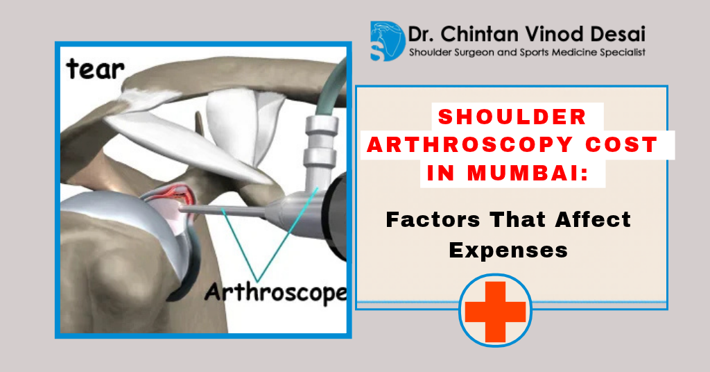 Read more about the article Shoulder Arthroscopy Cost in Mumbai: Factors That Affect Treatment Expenses