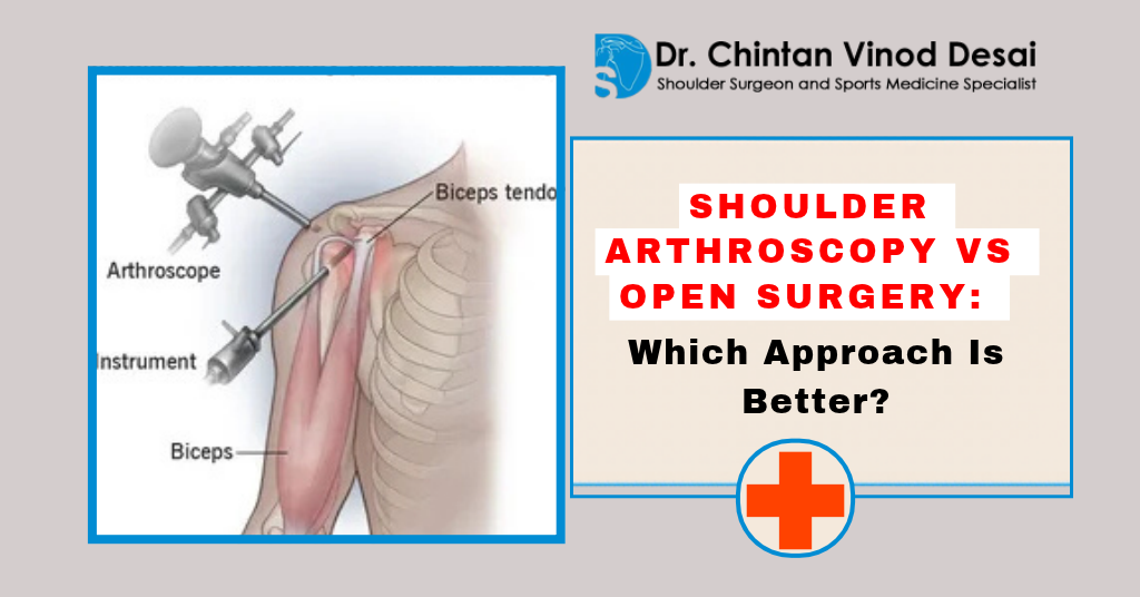 Read more about the article Shoulder Arthroscopy vs Open Surgery: Which Approach Is Better?
