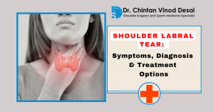 Read more about the article Shoulder Labral Tear: Symptoms, Diagnosis, and Treatment Options