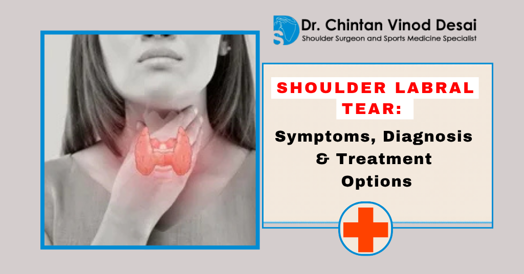 Read more about the article Shoulder Labral Tear: Symptoms, Diagnosis, and Treatment Options
